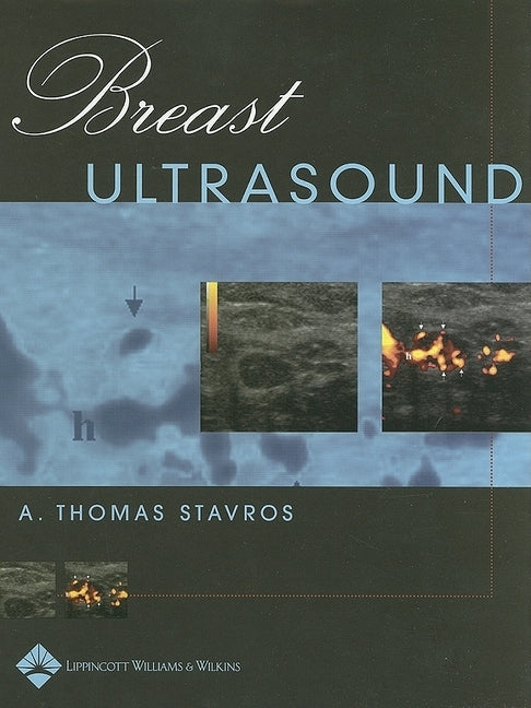 Breast Ultrasound