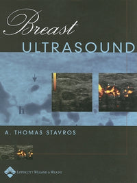 Breast Ultrasound